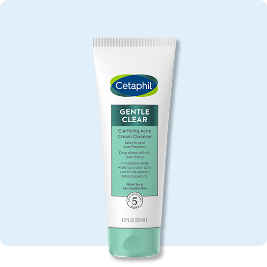 Acne Cream Cleanser to Clear Acne Breakouts